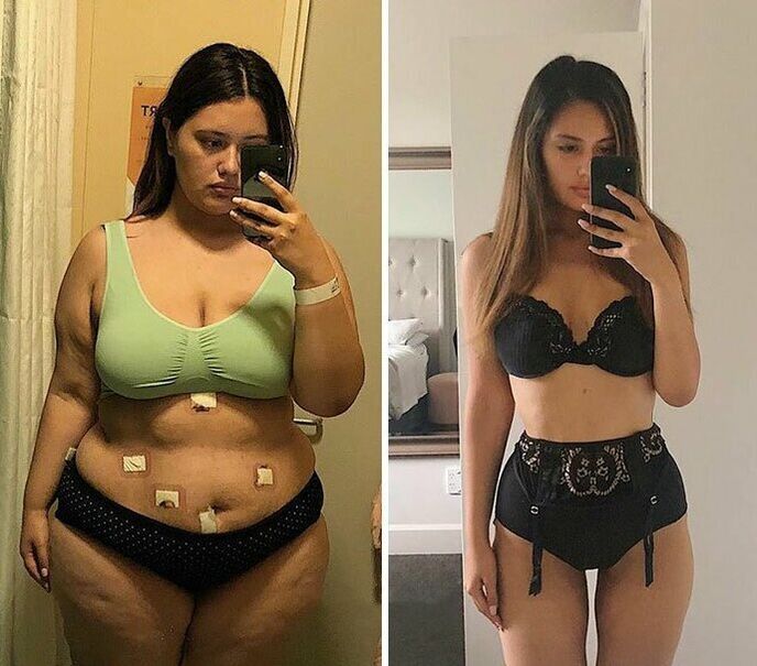 Girl before and after losing weight with NexaSlim capsules